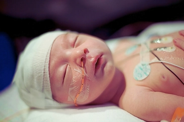 infant in hospital, representing the impact of a birth injury