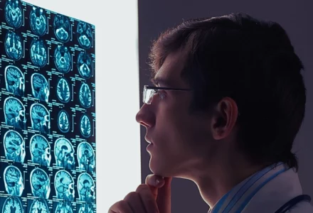 Doctor looking at the brain scans.